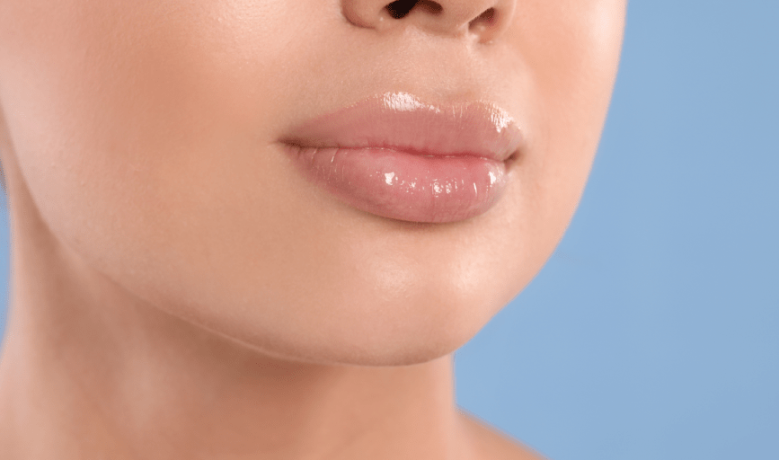 LIP FILLER